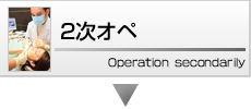 2次オペ