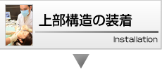 上部構造の装着